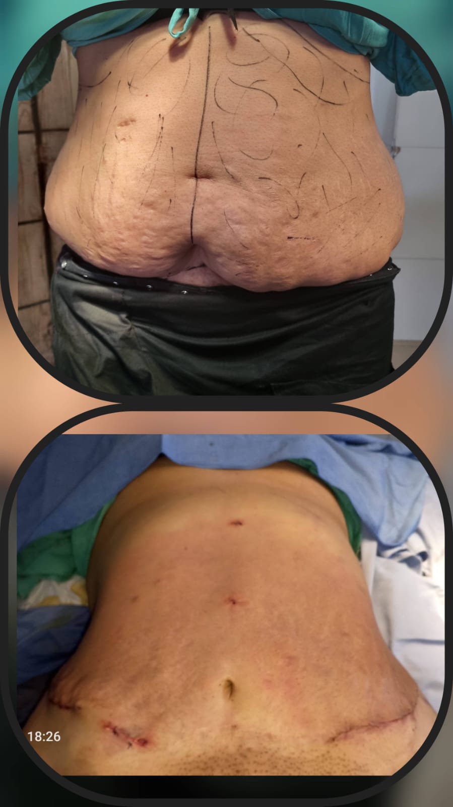 Before & After 30